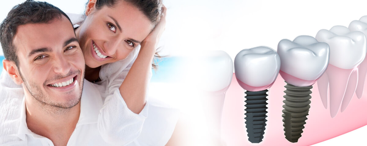 implantes-dentales-banner